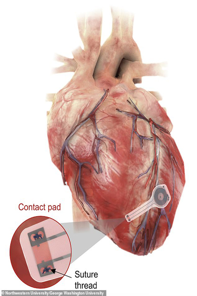با این ورزش سرخوش شوید! / اختراع یک وسیله وحشتناک برای دندان (گزارش تصویری)