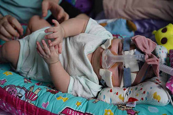 ترخیص کوچک ترین نوزاد جهان (عکس) ترخیص کوچک ترین نوزاد جهان (عکس)