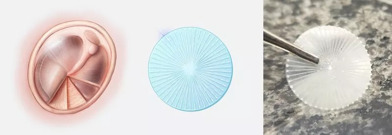 تولید پرده گوش مصنوعی با چاپگر سه‌بُعدی