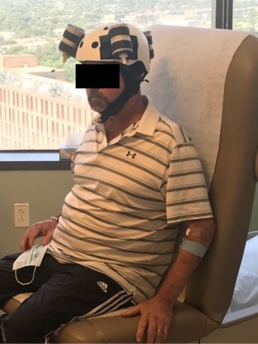 کلاه ایمنی مغناطیسی تومور مغزی کشنده را کوچک کرد