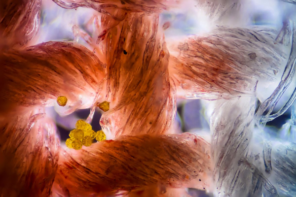 تصاویری شگفت انگیز و برگزیده از مسابقه «میکروگرافی» (گزارش تصویری)