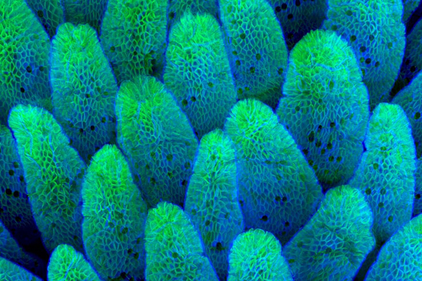 تصاویری شگفت انگیز و برگزیده از مسابقه «میکروگرافی» (گزارش تصویری)