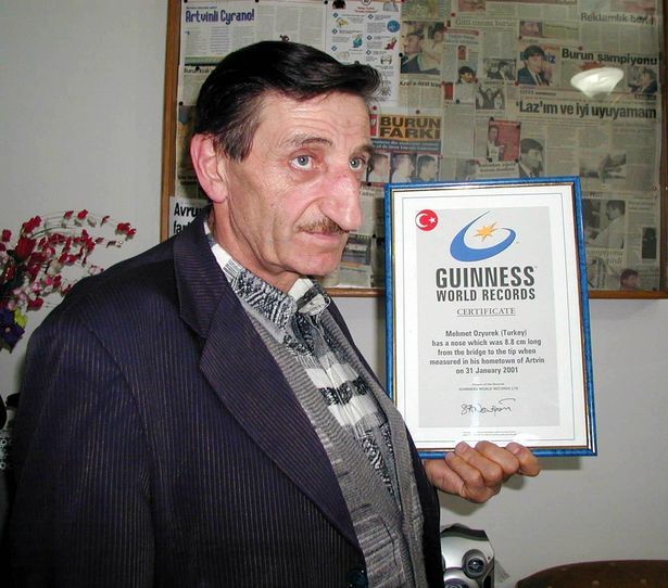 ثبت حد نصاب دراز‌ترین بینی جهان!