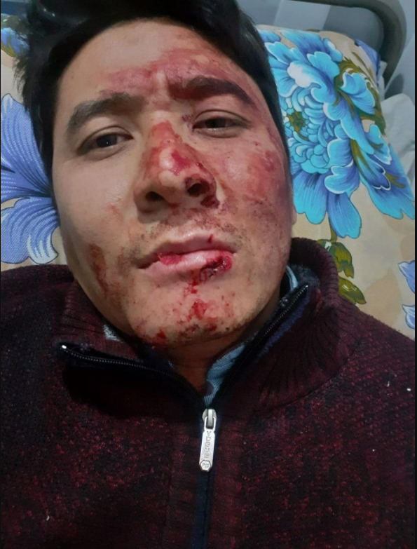 جزئیات ترور تصویربردار خبرگزاری صدا و سیما در کابل (عکس) جزئیات ترور تصویربردار خبرگزاری صدا و سیما در کابل (عکس)