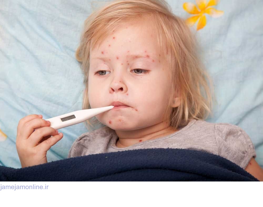 آغاز واکسیناسیون اتباع خارجی علیه سرخک و سرخچه در خوزستان