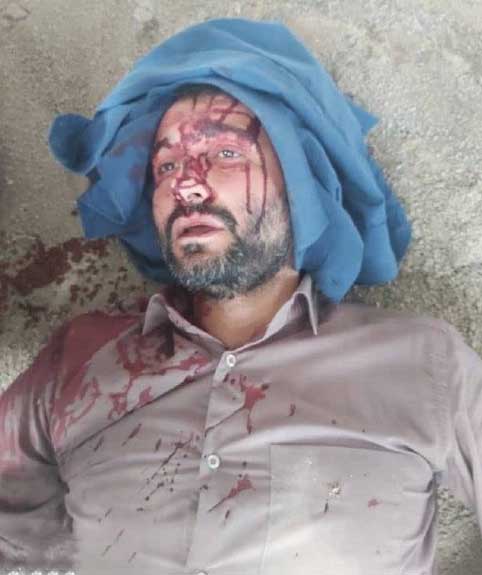 حمله به شهردار بخاطر مقابله با ساخت‌وسازهای غیرمجاز