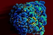 ویروس HIV فرایند پیری بدن را تسریع می کند
