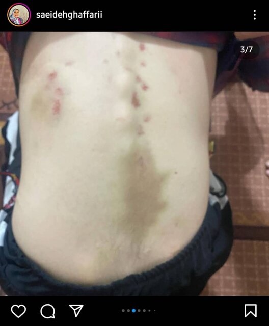 عکس| جزئیات ربودن شیطانیِ جوان مبتلا به اوتیسم