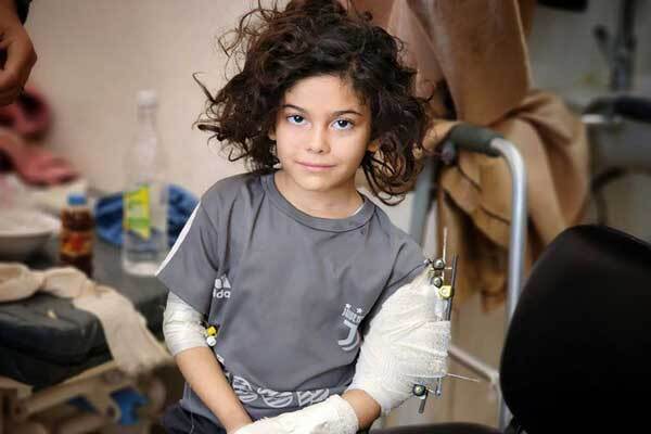 عکس | معلولیتهای کودکان فلسطینی در نتیجه حملات اشغالگران به غزه عکس | معلولیتهای کودکان فلسطینی در نتیجه حملات اشغالگران به غزه