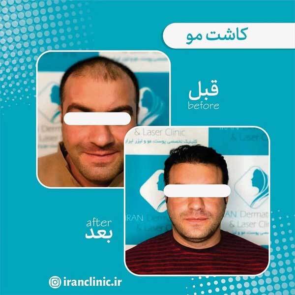 کلینیک پوست و مو ایران