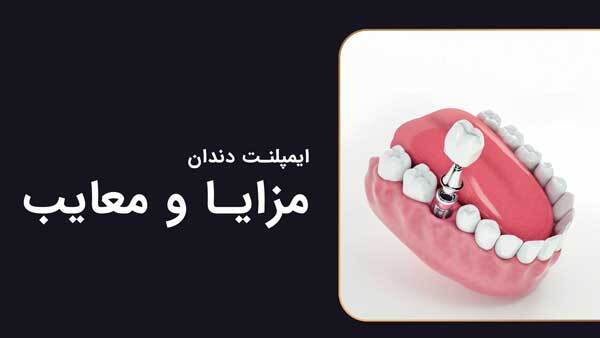 هر آنچه باید درباره ایمپلنت دندان بدانید: از ترس تا اعتماد