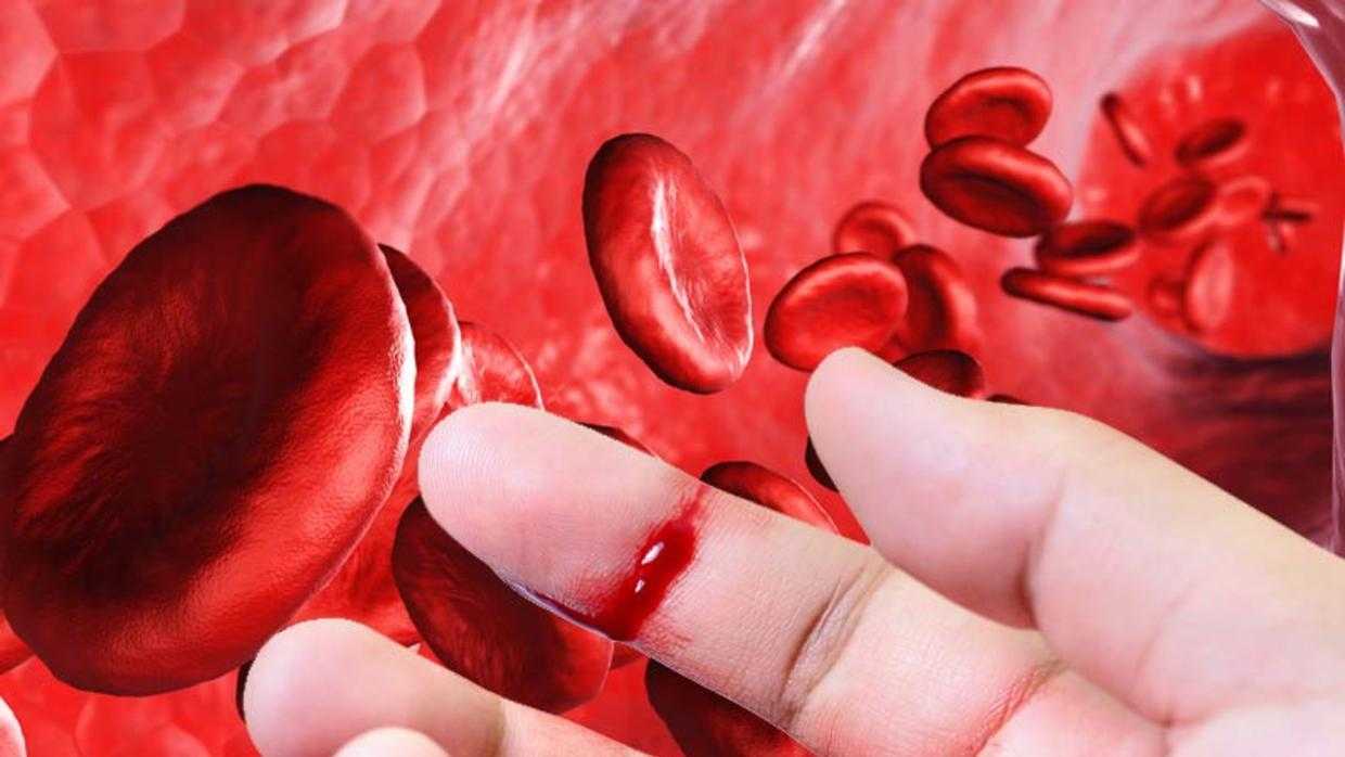 بازگشت به شیوه‌های درمانی 40 سال پیش | بیماران هموفیلی دارو ندارند  