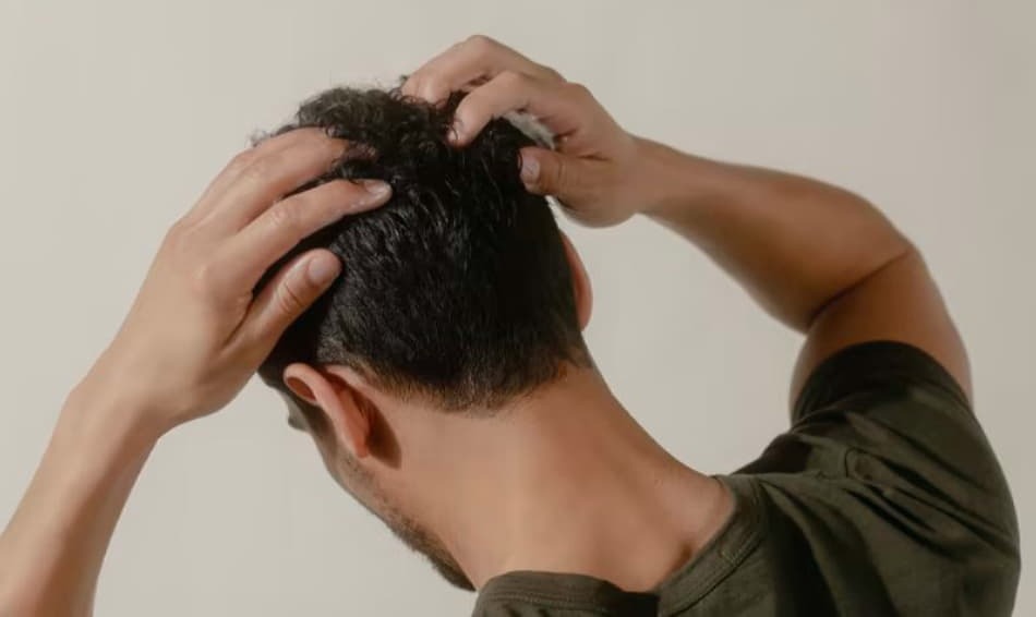 چه عواملی باعث ریزش موی سر می‌شوند؟
