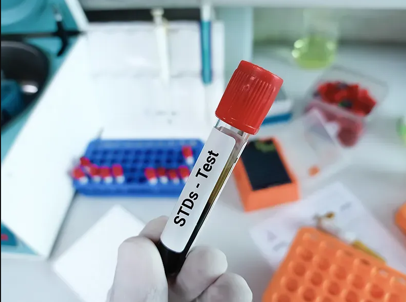 بیماری های مقاربتی STD و آزمایش های تشخیصی