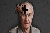 ردپای کم تحرکی در بروز آلزایمر