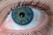 آبی رنگ شدن سفیدی چشم کودک نشانه چیست؟