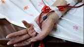 ابتلای ۱۳ هزار نفر به هموفیلی در ایران 