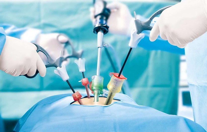 تشخیص کیست تخمدان و اقدامات لازم تشخیص کیست تخمدان و اقدامات لازم