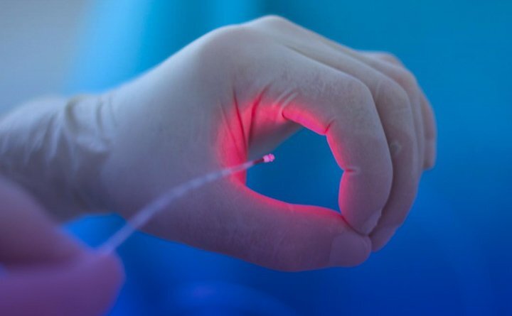 لیزر درمانی بواسیر