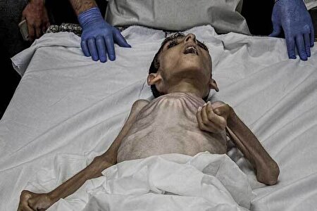 شهادت ۳۰ کودک در نتیجه گرسنگی در غزه