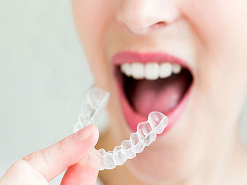 آیا متخصص ارتودنسی همان دندانپزشک است؟ آیا متخصص ارتودنسی همان دندانپزشک است؟