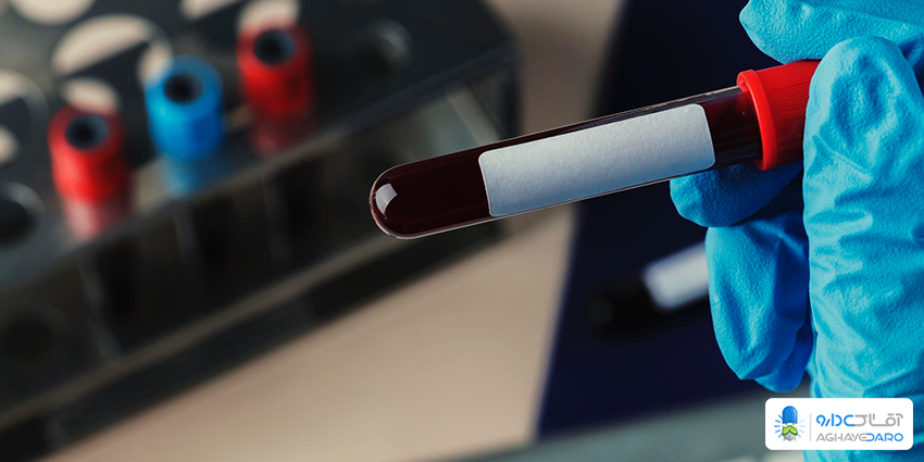 همه چیز درباره عفونت خون: خطرات، علائم و راههای پیشگیری همه چیز درباره عفونت خون: خطرات، علائم و راههای پیشگیری