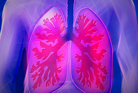 سریع ترین روش های درمان آب آوردن ریه در سالمندان