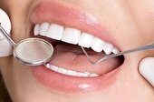 هر واحد دندان دقیقا یعنی چه؟ + قیمت لمینت دندان 1404