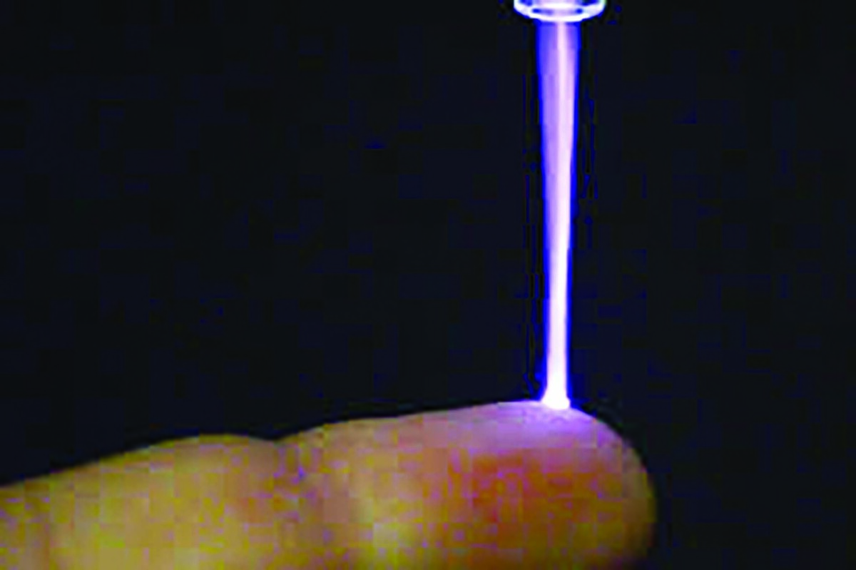 پلاسما پزشکی حوزه‌ای نوآورانه و نوظهور است که فیزیک پلاسما، علوم زیستی و پزشکی بالینی را با هم ترکیب می‌کند. در یک دیدگاه کلی‌تر، کاربرد پلاسما در پزشکی را می‌توان به دو رویکرد اصلی تقسیم کرد: اول، استفاده «غیرمستقیم» از تکنیک‌های مبتنی بر پلاسما یا پلاسمای مکمل برای درمان سطوح، مواد یا دستگاه‌ها به منظور دستیابی به ویژگی‌های خاص برای کاربردهای پزشکی ویژه و دوم، کاربرد پلاسما رو یا داخل بدن انسان یا حیوان برای تحقق اثرات درمانی بر اساس تعامل مستقیم پلاسما با بافت زنده.