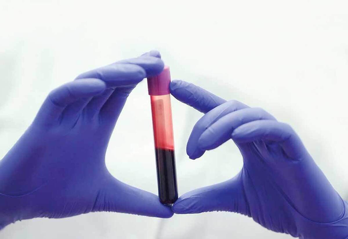 پژوهش‌های تازه نشان می‌دهد خون افراد بسیار طولانی‌عمر تفاوت‌های بنیادینی با دیگران دارد؛ تفاوت‌هایی که می‌تواند کلید زندگی سالم‌تر و طولانی‌تر باشد.این پرسش که چرا بعضی انسان‌ها تا صد سالگی و حتی فراتر از آن زندگی می‌کنند، در حالی که بسیاری دیگر زودتر با بیماری و ناتوانی مواجه می‌شوند، مدت‌هاست ذهن دانشمندان را به خود مشغول کرده است. اکنون پژوهش‌های جدید نشان می‌دهد که بخشی از پاسخ این معما ممکن است در چیزی پنهان باشد که پیوسته در رگ‌های ما جریان دارد: خون.