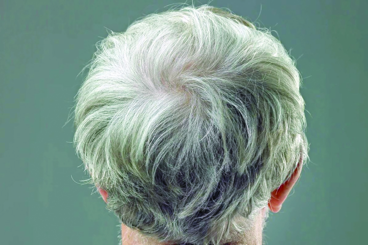 سفید شدن مو از دیرباز نمادی از استرس و گذر زمان بوده است. کافی است نگاهی به عکس‌های قبل و بعد نخست‌وزیران و رؤسای‌جمهور بیندازید تا ببینید قدرت چگونه موها را خاکستری می‌کند. با رسیدن به ۶۰سالگی حدود ۹۰درصد انسان‌ها دست‌کم بخشی از موهای‌شان سفید می‌شود.