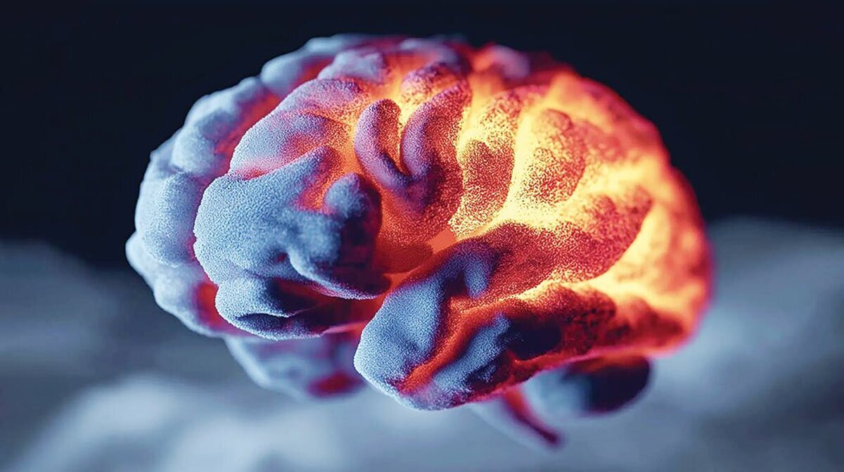 پژوهشگران آمریکایی اخیرا به کشفی مهم در حوزه سلامت مغز دست یافته‌اند؛ یک بیماری عروقی مغزی که اغلب بدون علامت است، می‌تواند خطر ابتلا به زوال عقل را تا چهار برابر افزایش دهد. این یافته هشدار مهمی برای پزشکان و خانواده‌هاست و ضرورت غربالگری زودهنگام و مراقبت‌های پیشگیرانه را برجسته می‌کند.