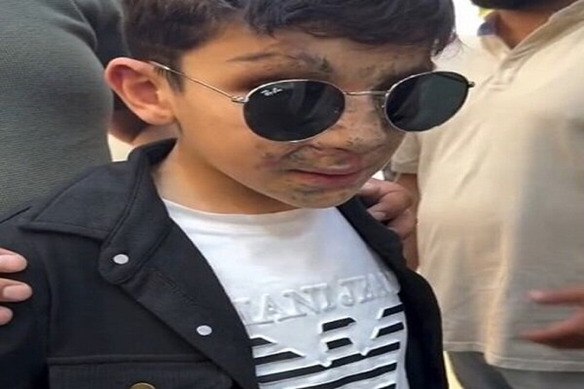 منابع عراقی اعلام کردند که شماری از مجروحان انفجار پیجرهای لبنان امروز با آیت الله سیستانی دیدار کردند.
