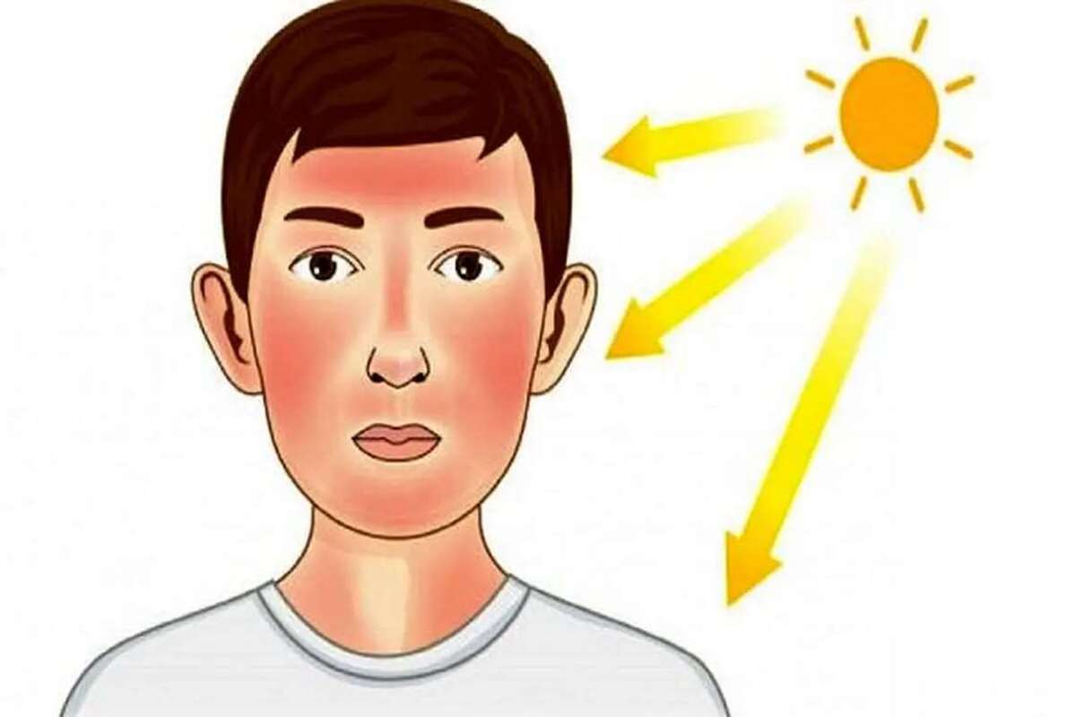 مراقبت از پوست در برابر آفتاب تابستان، ضروری‌تر از همیشه