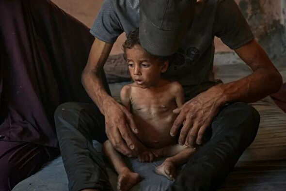گزارش سخنگوی سازمان ملل از تشدید گرسنگی و سوء تغذیه در غزه