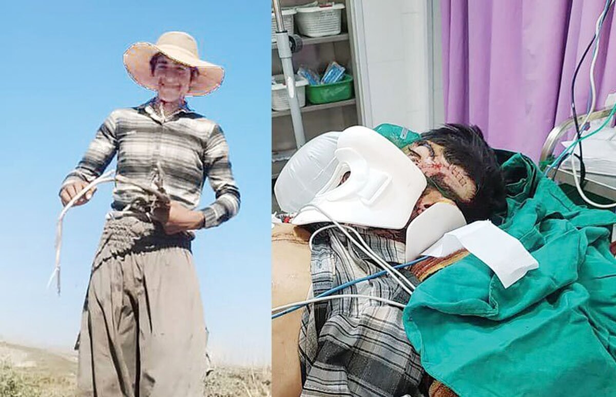 جدال خونین با ۲ خرس گرسنه