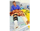 یک جنگلبان هنگام آب‌رسانی به حیوانات در بردسکن خراسان رضوی مصدوم شد