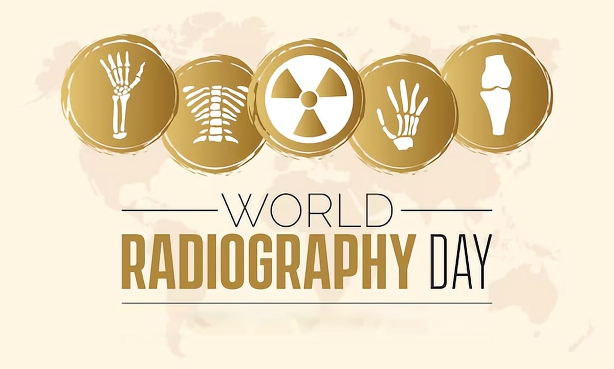 درهشتمین روز از نوامبرسال۱۸۹۵،ابزاری کشف شدکه ازطریق آن متخصصان توانستند بهترازپیش،فردرا درخصوص وضعیت درونی‌اش آگاه کنند اماحالا رادیولوژی از یک ابزار تشخیص ساده سال‌های دور،تبدیل به یکی ازستون‌های پیشرفت درمان شده است؛ستونی ازنظام تشخیصی ودرمانی کشورکه برخلاف محدودیت‌های اقتصادی و تجهیزاتی، از نظرتوان علمی وتخصصی پزشکان رادیولوژیست،بسیار خوش درخشیده و ایران را به صدر برترین‌های رادیولوژی در دنیا رسانده.۱۷ آبان و روزجهانی رادیولوژی،فرصتی است برای مرورهرآنچه در این سال‌هابر رادیولوژی گذشته است. 