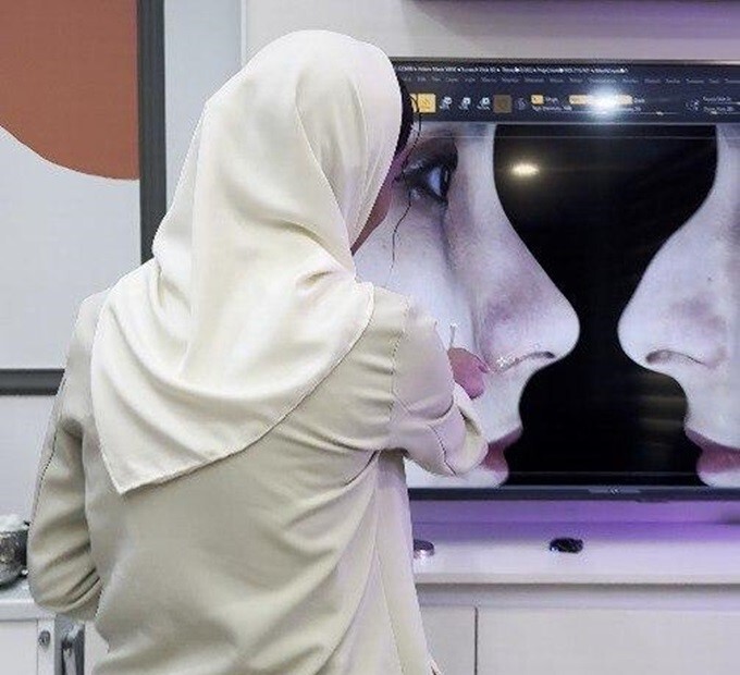 قبل از اینکه تصمیم بگیرم جراحی بینی انجام بدم، این تجربه راوانا مسیرم را تغيير داد! قبل از اینکه تصمیم بگیرم جراحی بینی انجام بدم، این تجربه راوانا مسیرم را تغيير داد!