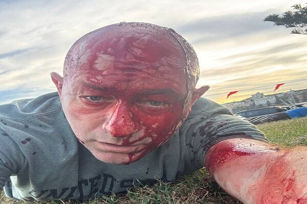 تیراندازی در مراسم یهودی ها در استرالیا تیراندازی در مراسم یهودی ها در استرالیا