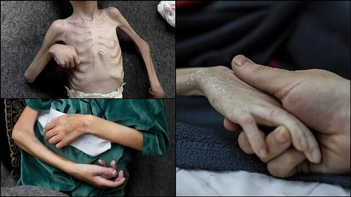 مدیر دفتر اطلاع رسانی دولتی نوار غزه اعلام کرد که میزان سوء تغذیه میان شهروندان در این باریکه از ۹۰ درصد فراتر رفته است.