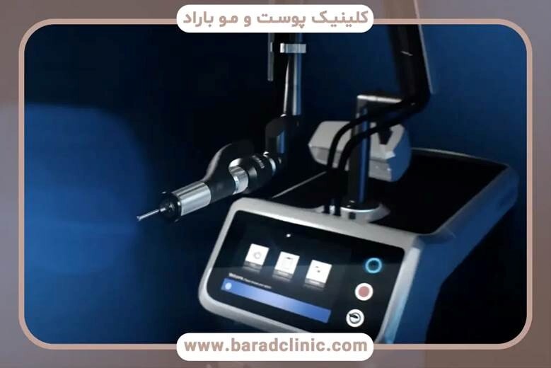 چشم‌های جوان‌تر با یک تکنولوژی نوین: تجربه بلفاروپلاستی با لیزر